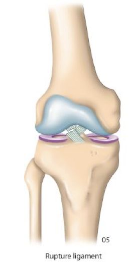 L1.jpg