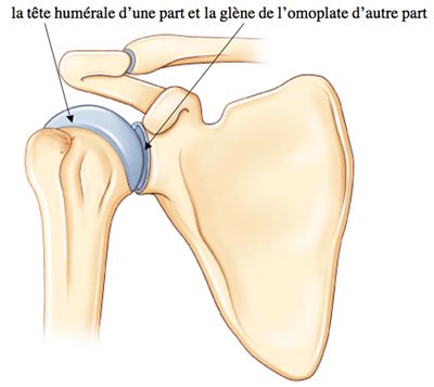 fracture épaule 2.jpg