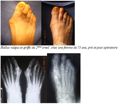 pied 4.jpg