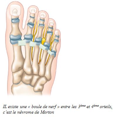 pied 5.jpg
