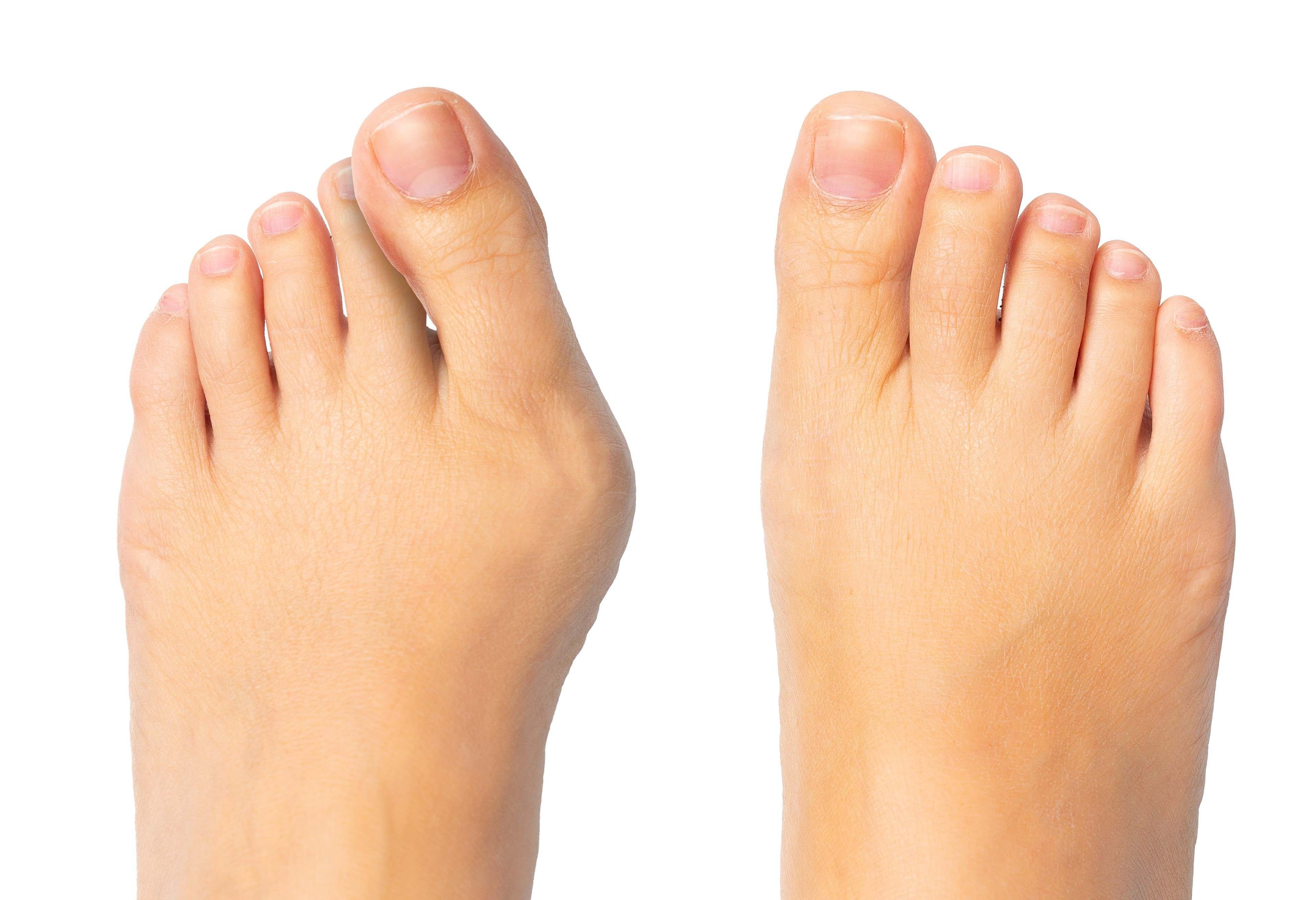 pieds site 2.jpg