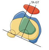 rotule5.jpg