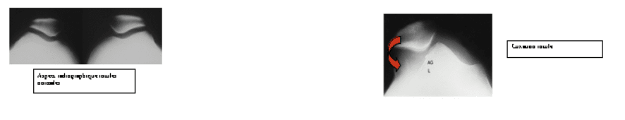 rotule 10.png